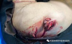 你們與我一起，共同戰(zhàn)勝死神！