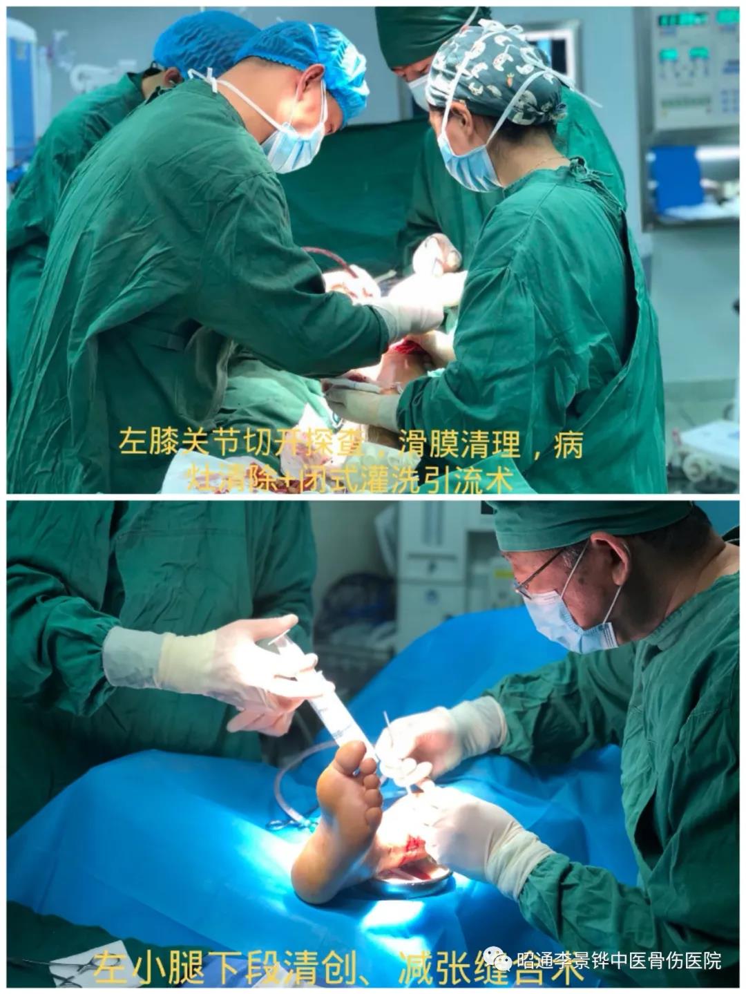 你們與我一起，共同戰(zhàn)勝死神！-昭通李景鏵中醫(yī)骨傷醫(yī)院