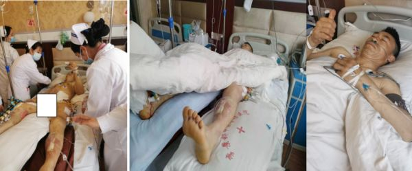 南丁格爾提燈指方向 護理天使謹誓救死傷-昭通李景鏵中醫(yī)骨傷醫(yī)院